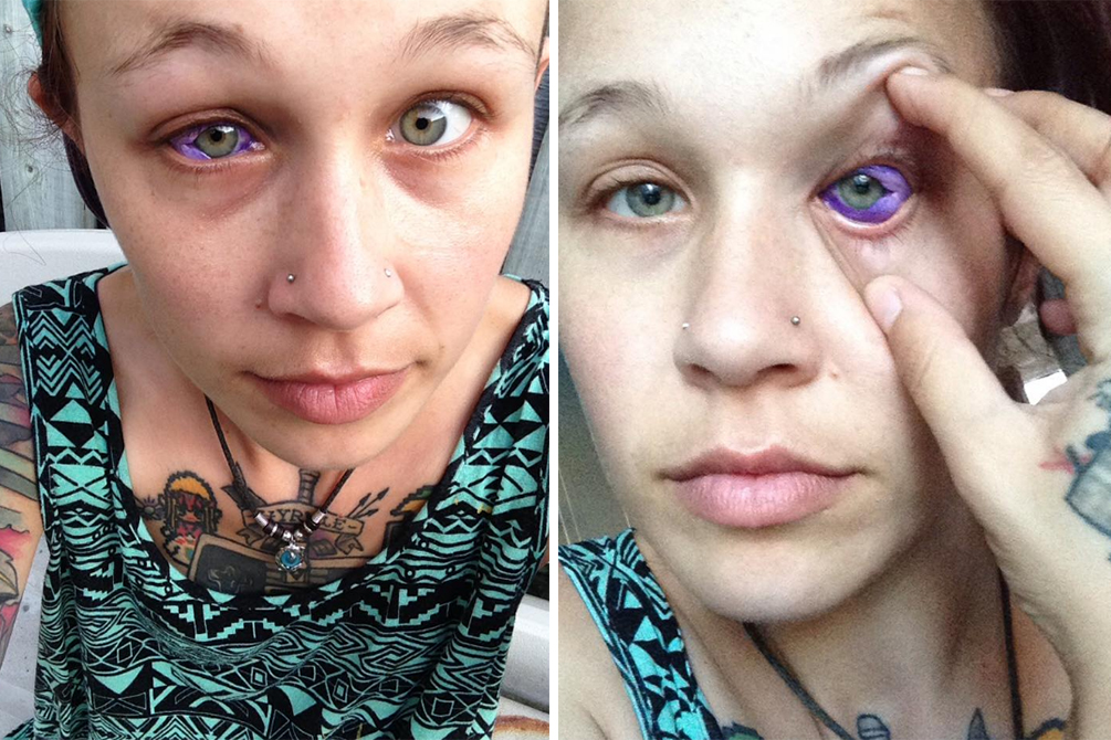 tatuagem-cegueira-02