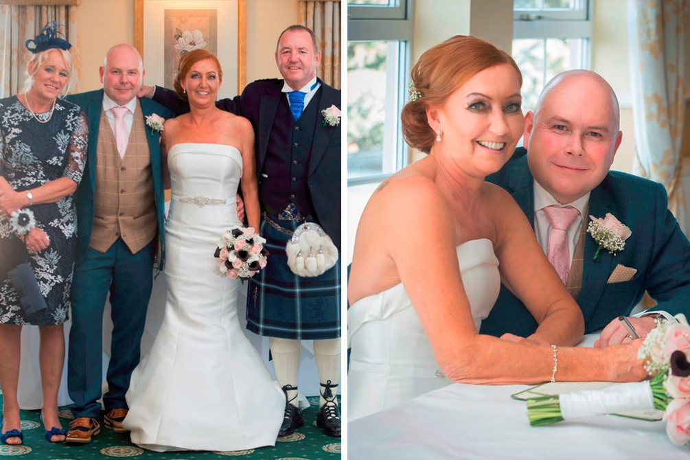 noiva-transplante-casamento-02