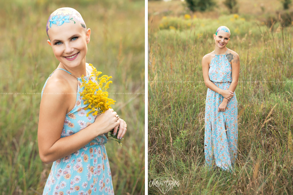 mae-pinta-cabeca-filha-alopecia-03