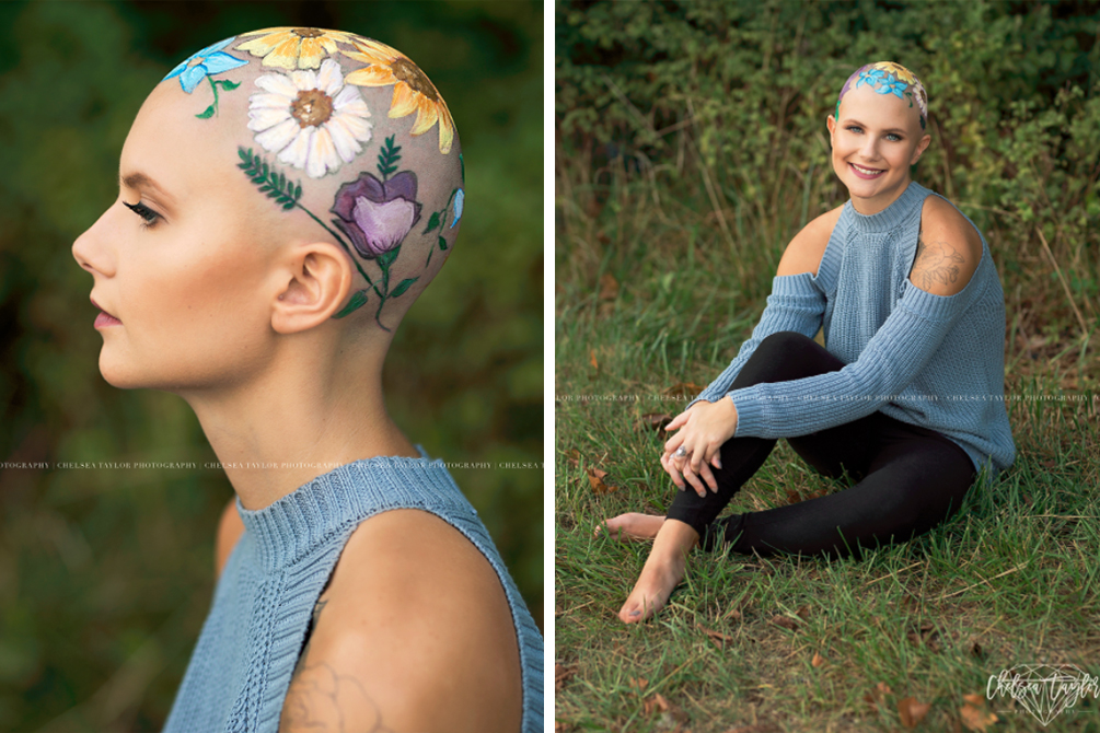 mae-pinta-cabeca-filha-alopecia-04