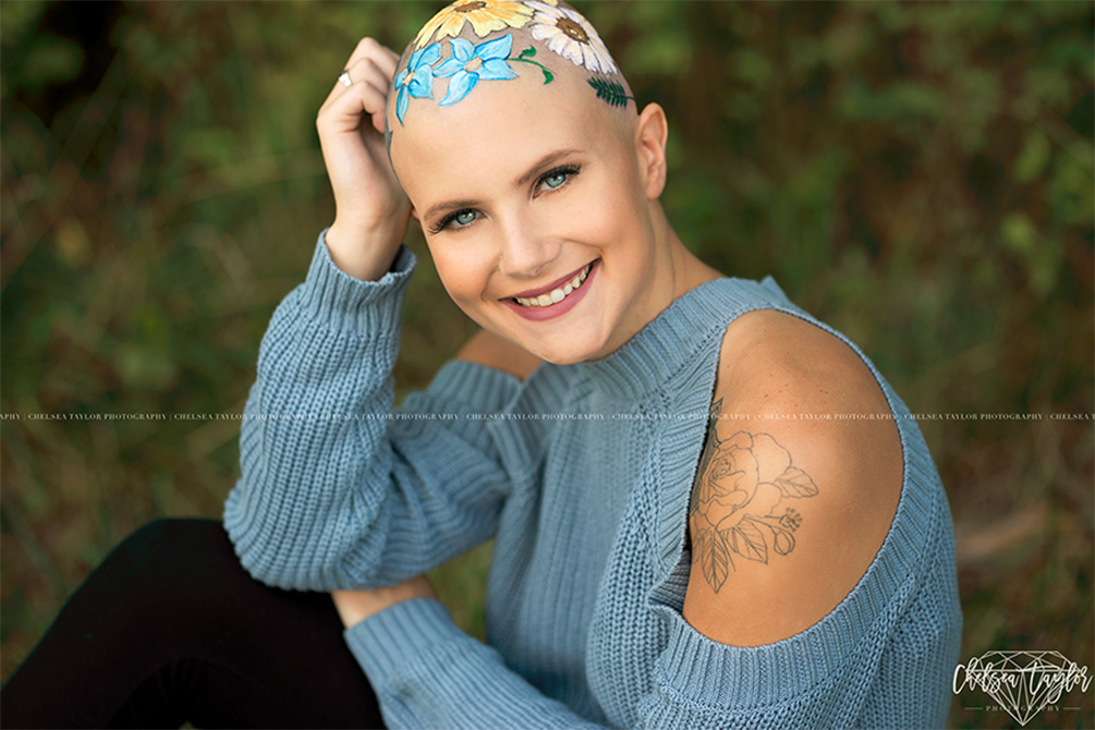 mae-pinta-cabeca-filha-alopecia-05