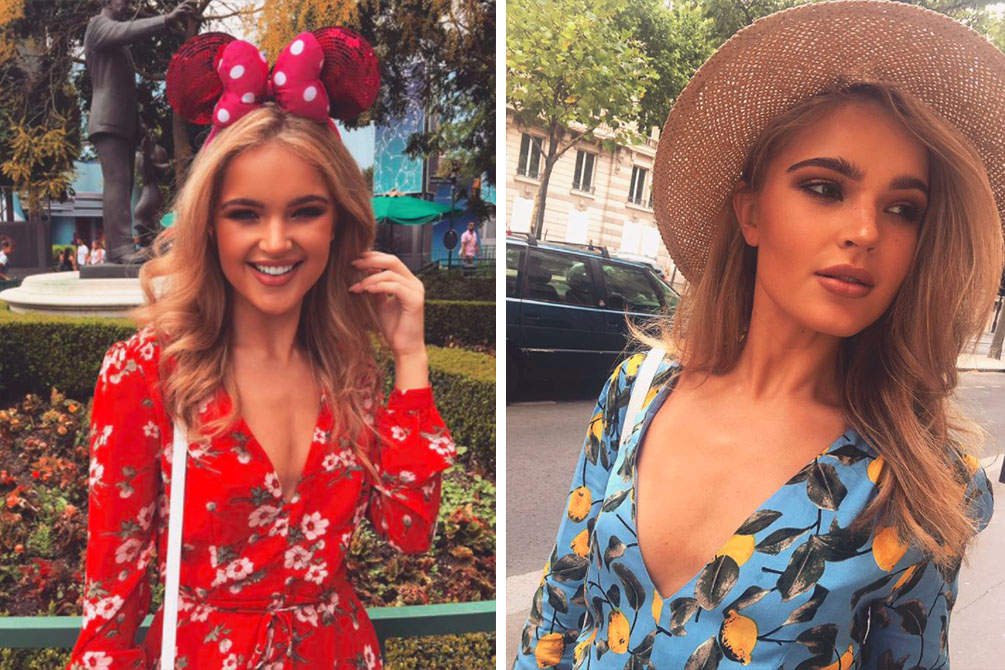 Modelo de 20 anos mostra fotos e faz alerta após susto com pintas