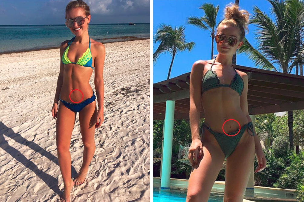 alerta-bronzeamento-artificial-03