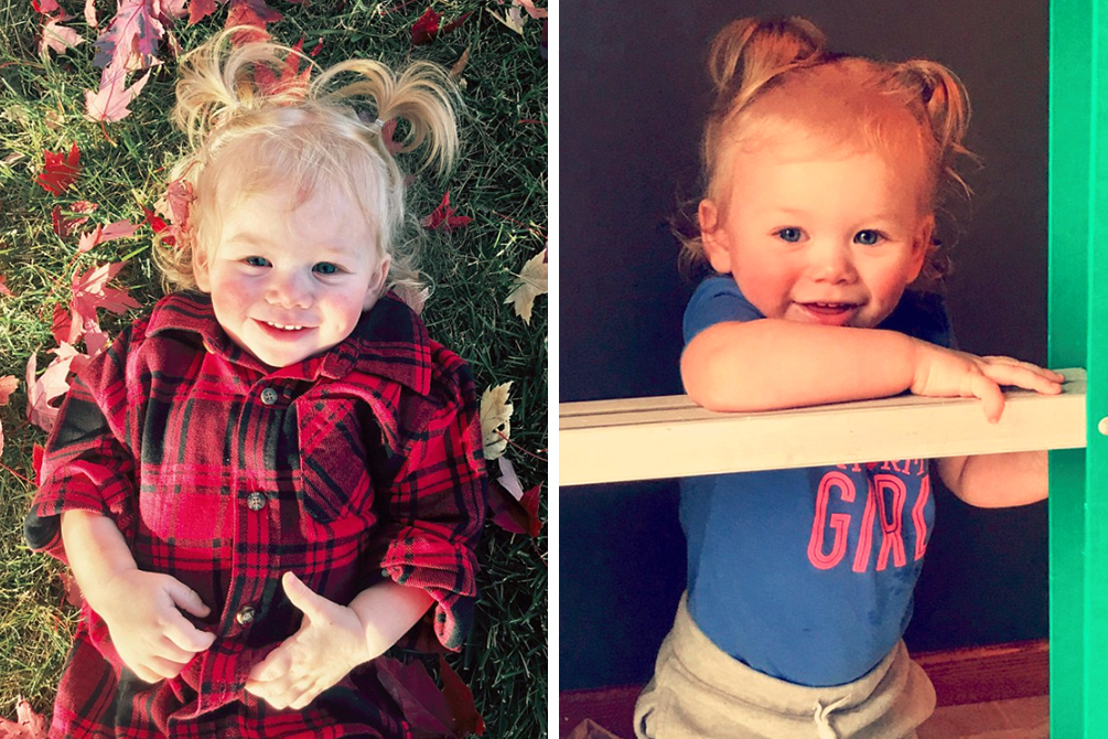 Alérgica a água, criança não pode tomar banho, chorar ou suar