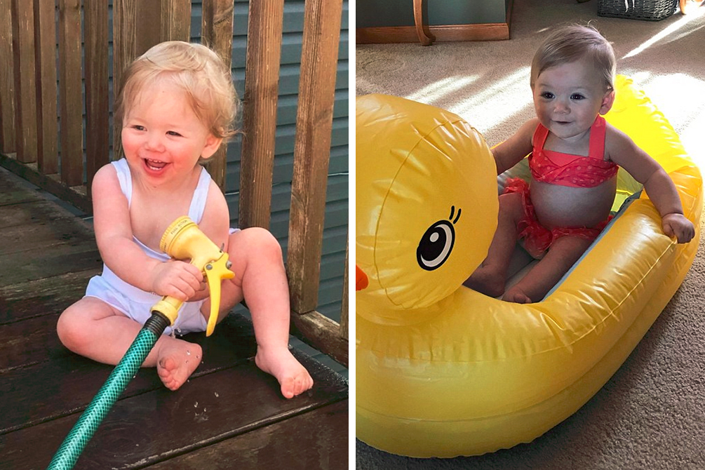 menina-alergia-agua-03