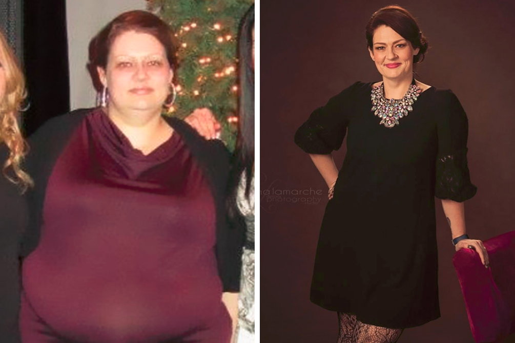 antes-depois-dicas-emagrecimento-03