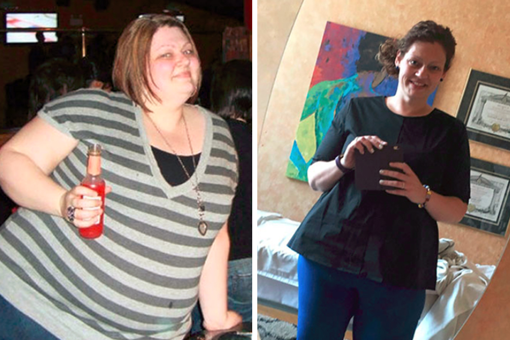 antes-depois-dicas-emagrecimento-05