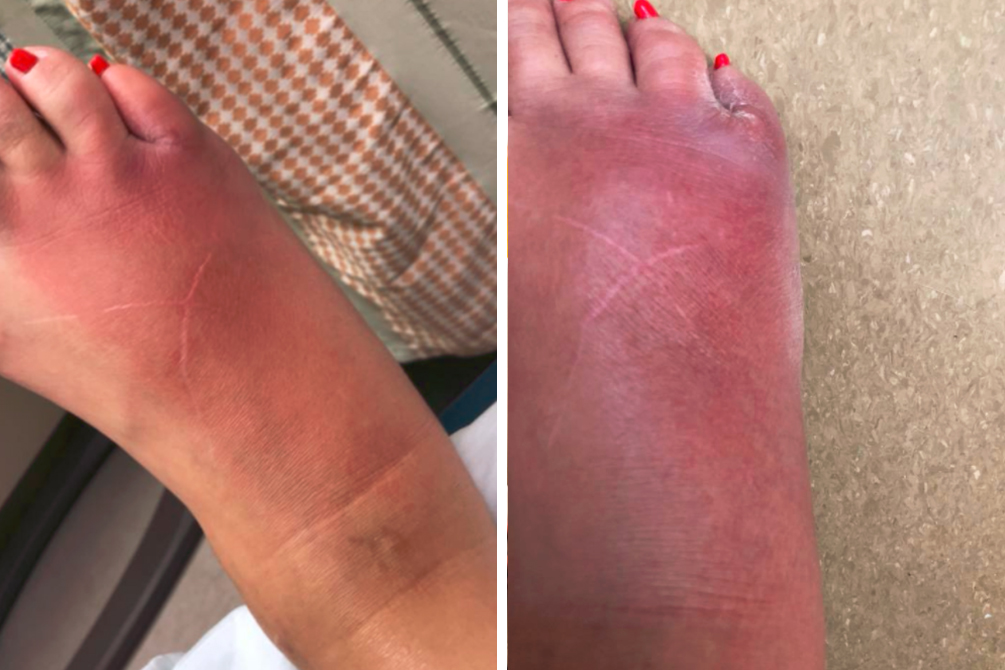 pedicure-susto-facebook-01