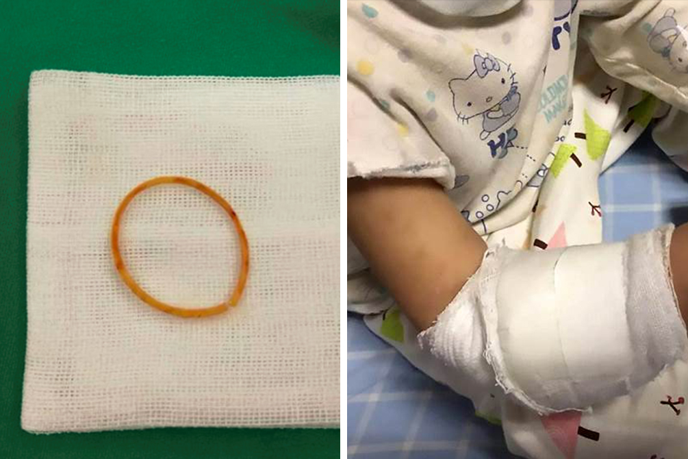 alerta-objeto-inesperado-crianca-03