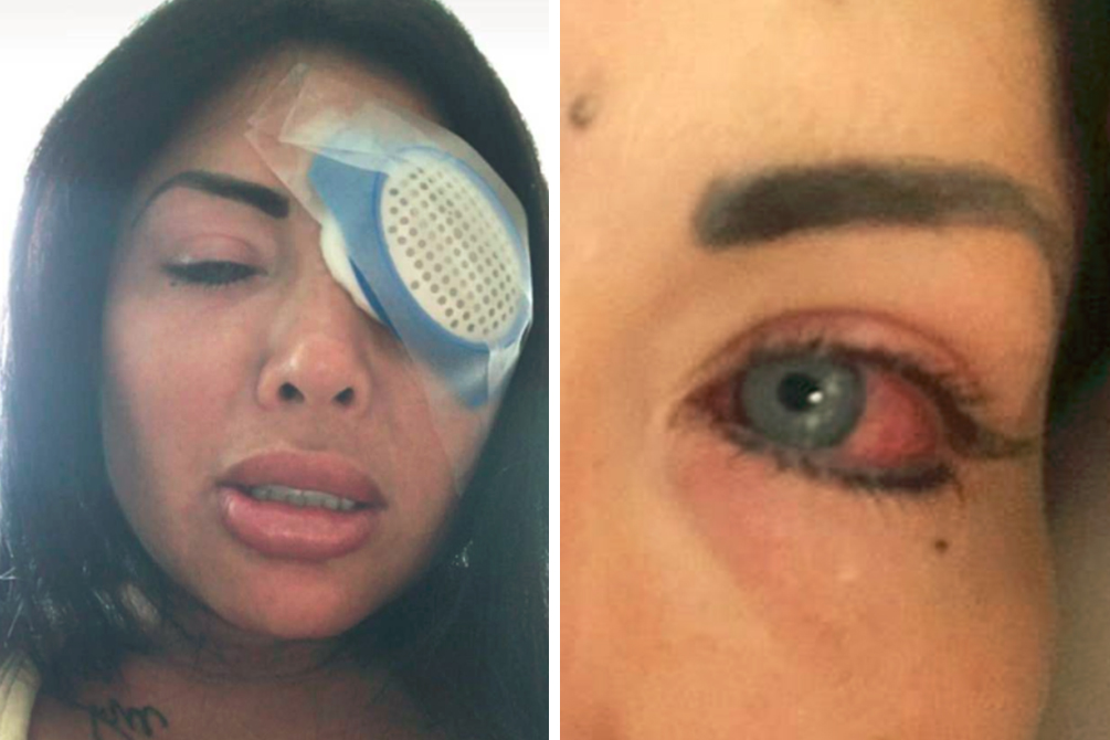 mulher-perde-visao-cirurgia-controversa-03