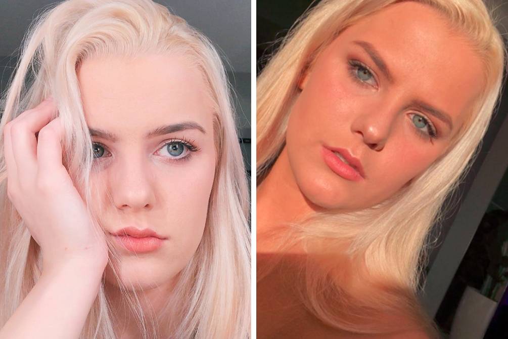 Jovem revela por que se arrependeu de chorar após bronzeamento artificial