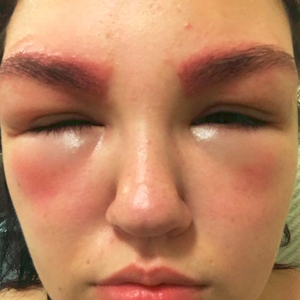 mulher-vergonha-procedimento-estetico-04