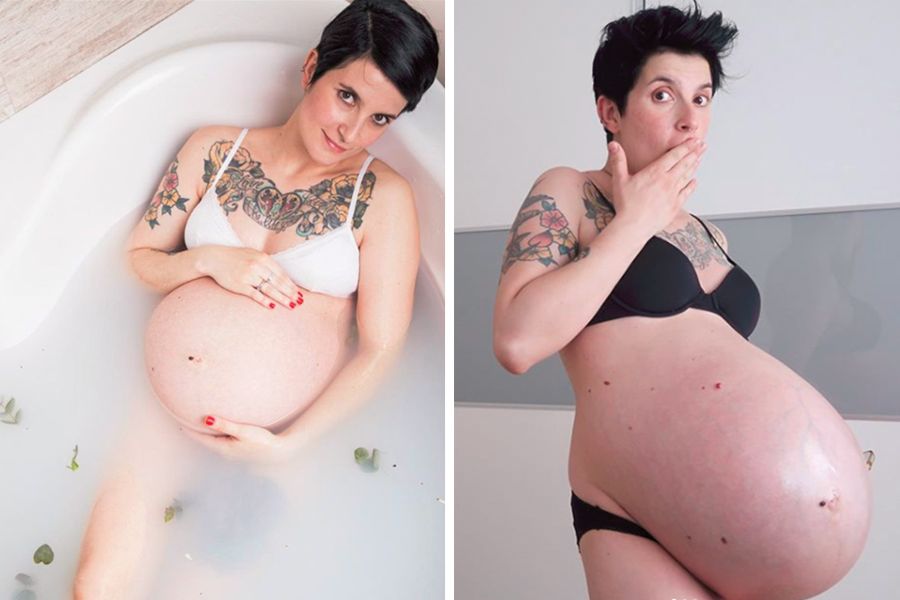 Mãe comove internautas no Instagram com clique de barriga após o parto