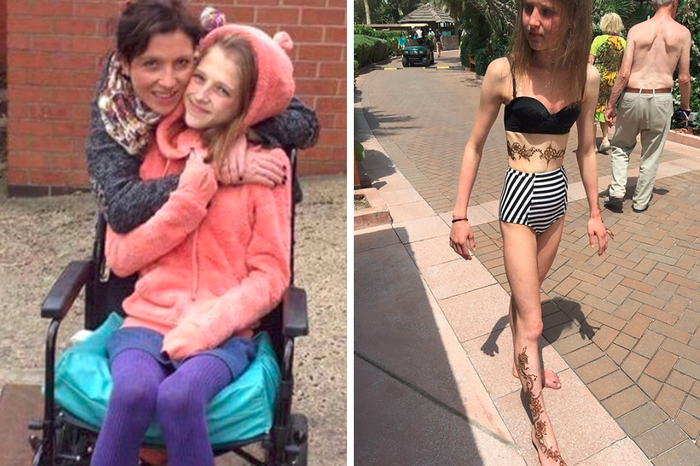 Jovem com anorexia revela como fisiculturismo salvou a sua vida