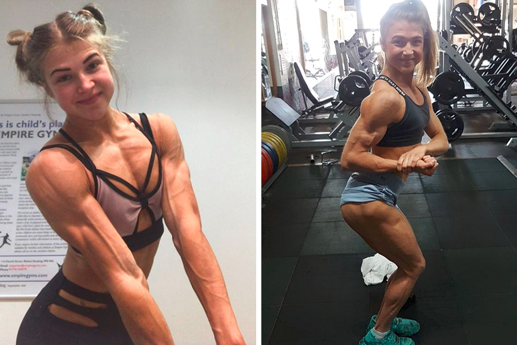 jovem-anorexia-bodybuilding-03