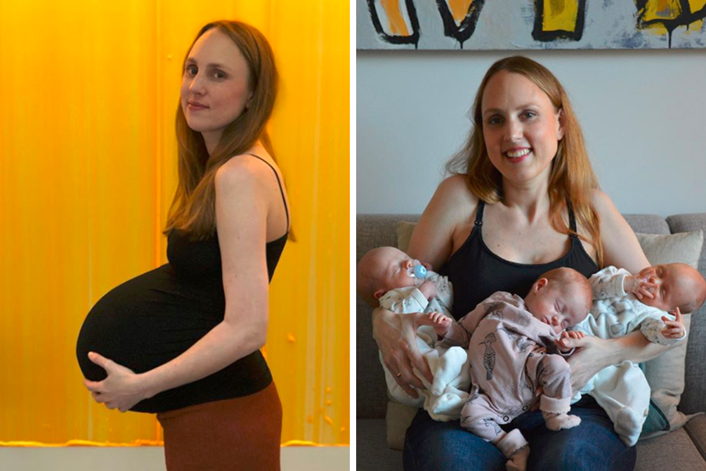 Mulher desabafa sobre pós-parto no Instagram após dar à luz trigêmeos