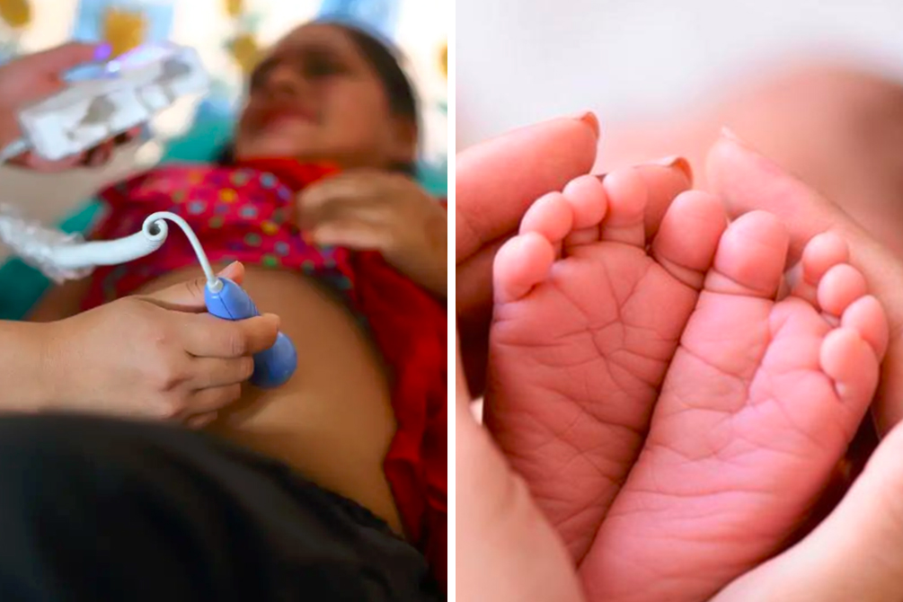 Mulher dá à luz gêmeos um mês após parto do primeiro filho