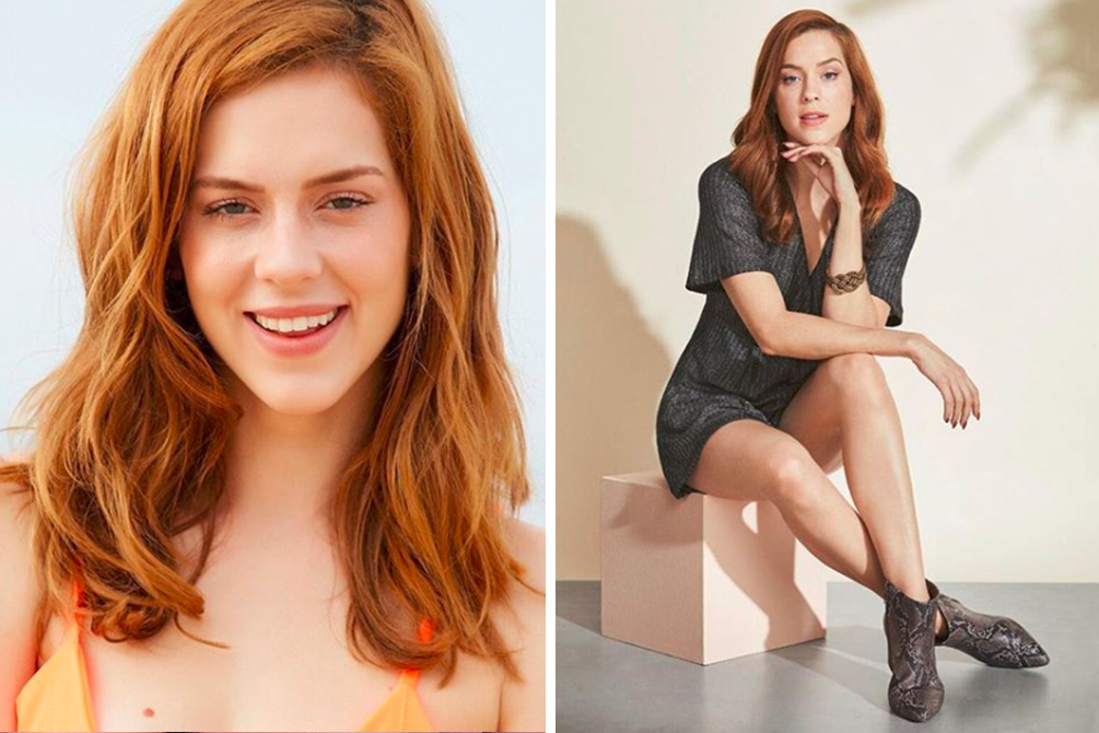 Sophia Abrahão compartilha primeira foto após procedimento estético