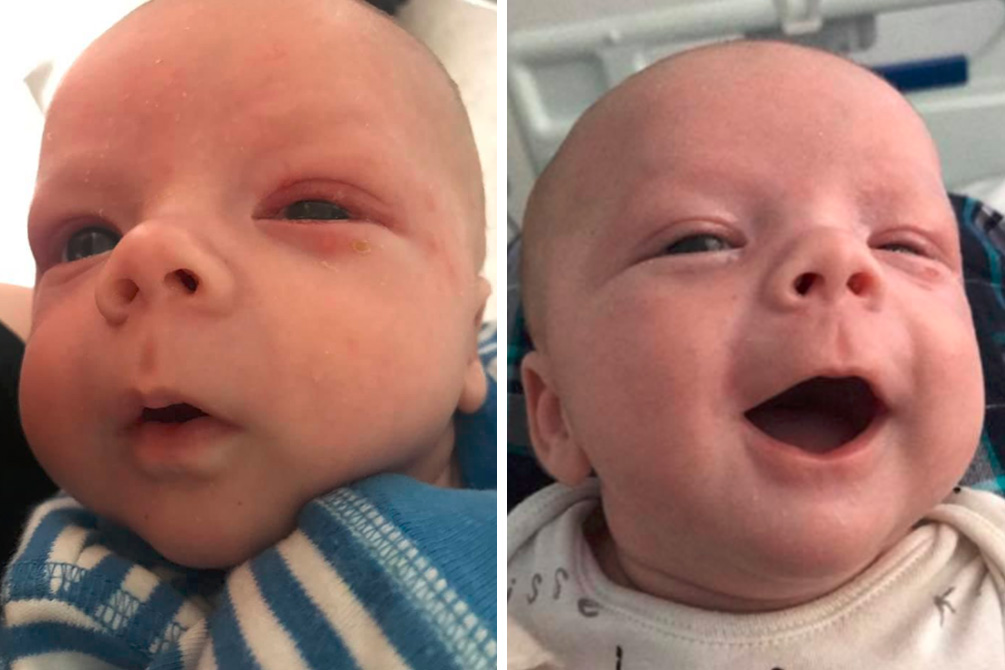 Bebê de 4 meses quase morre após ser beijado no rosto em batizado