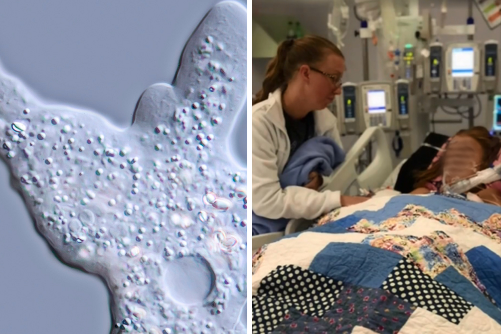 Menina de 10 anos morre após contrair ameba “comedora” de cérebros