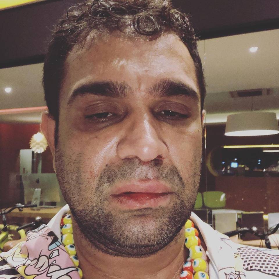 Evandro Santo, o Christian Pior, leva soco de homem da plateia em show