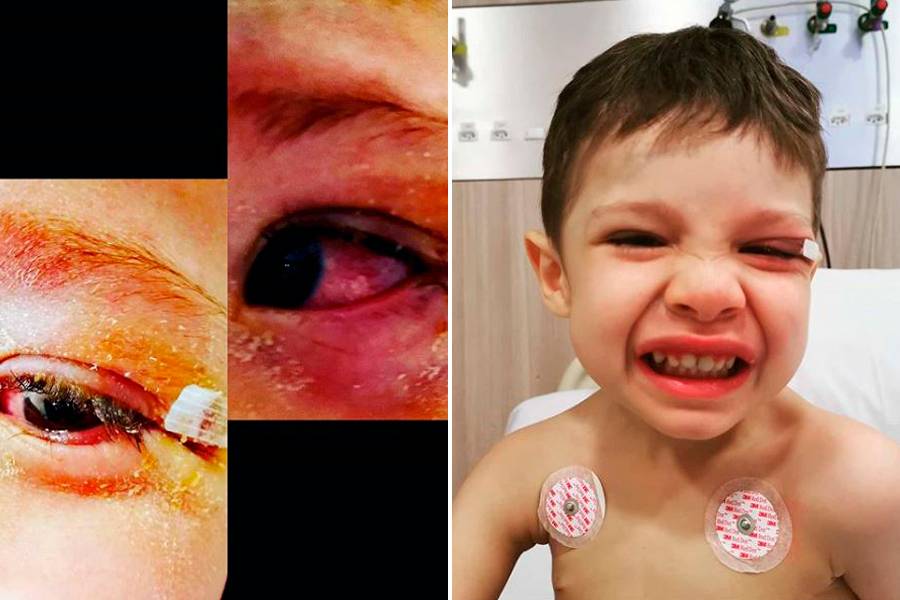 Pai afirma que filho de 4 anos teve pálpebra colada em hospital