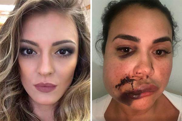 Modelo que agrediu mulher no Jockey divulga pedido de desculpas