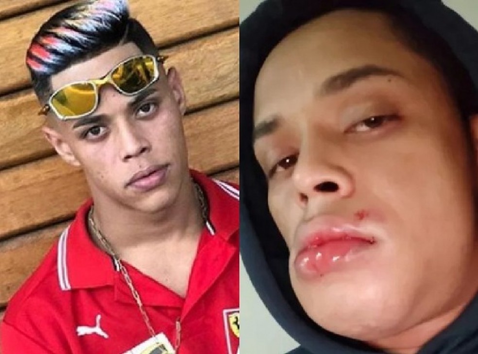 Influencer de manobras com moto sofre acidente e fica com rosto deformado