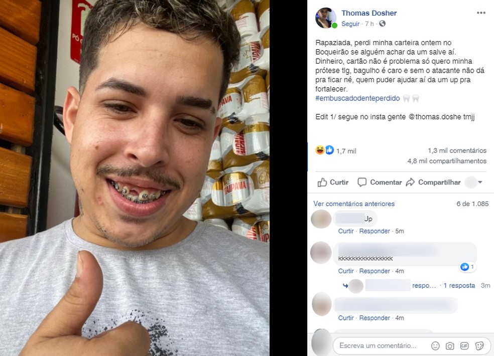 jovem-perde-dente