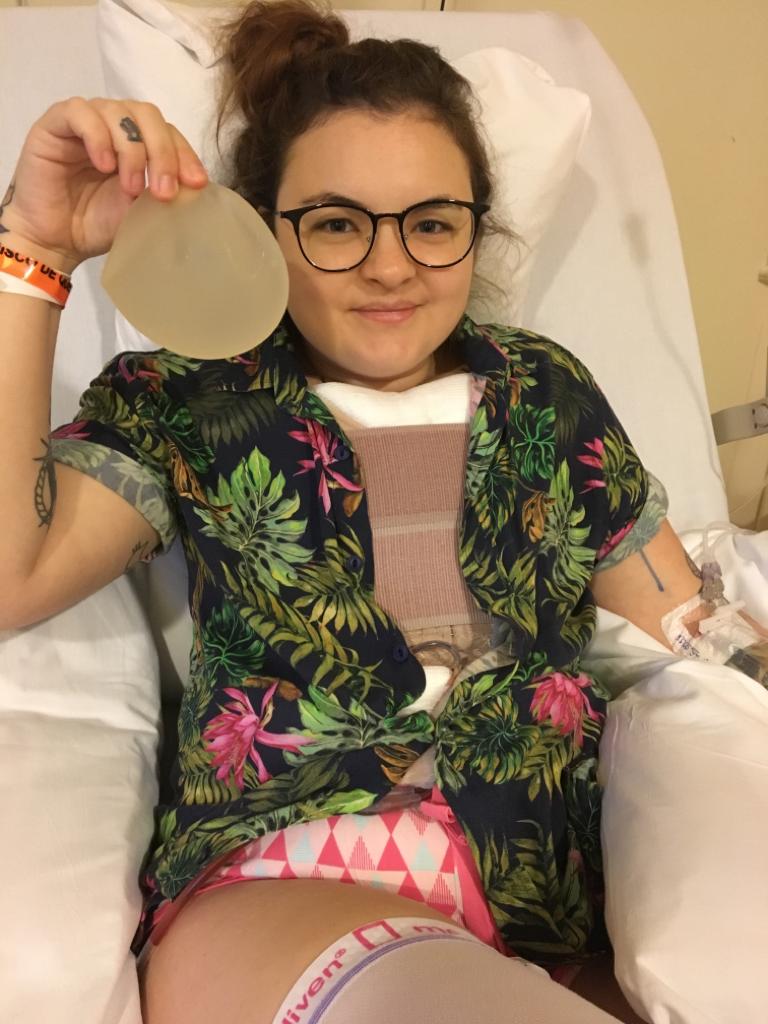 Bianca Malandrino Explante de Silicone Bianca Malandrino, uma das moderadoras em São Paulo do grupo sobre explante de silicone no Facebook: