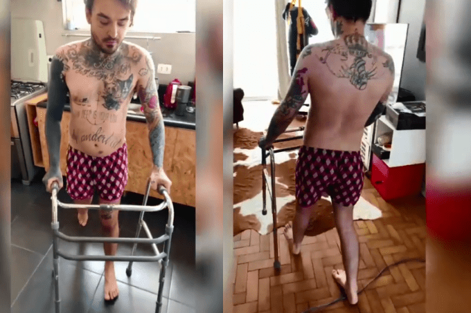 Após cirurgia por doença degenerativa rara, PC Siqueira reaprende a andar