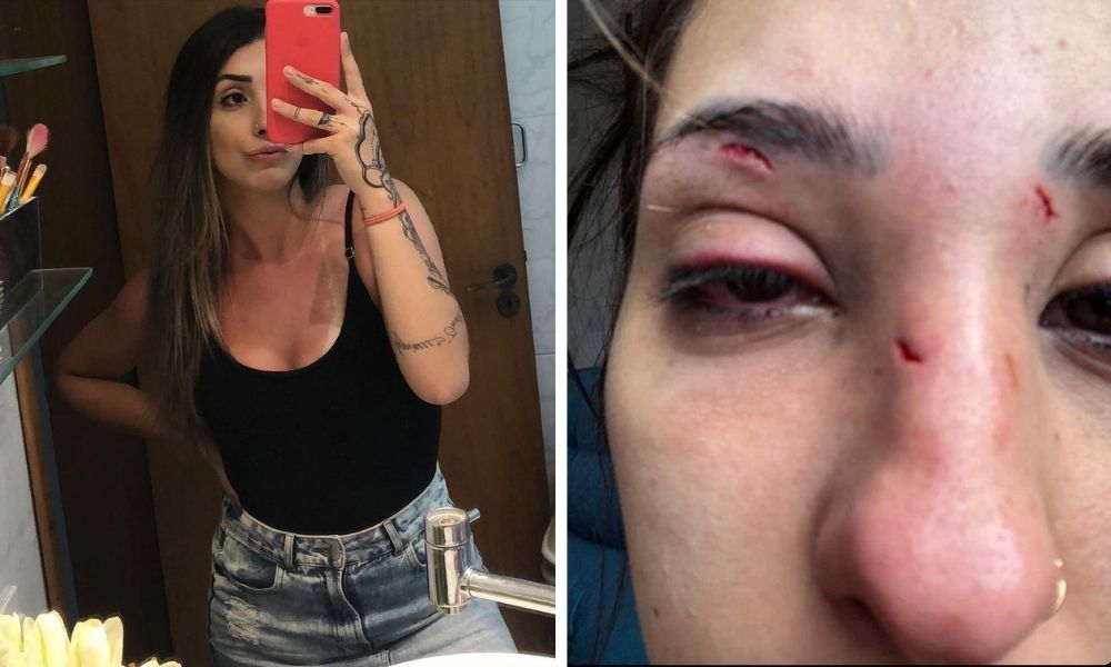 Gabriela posando frente a um espelho e na outra metade da foto, o rosto da Gabriela machucado após as agressões