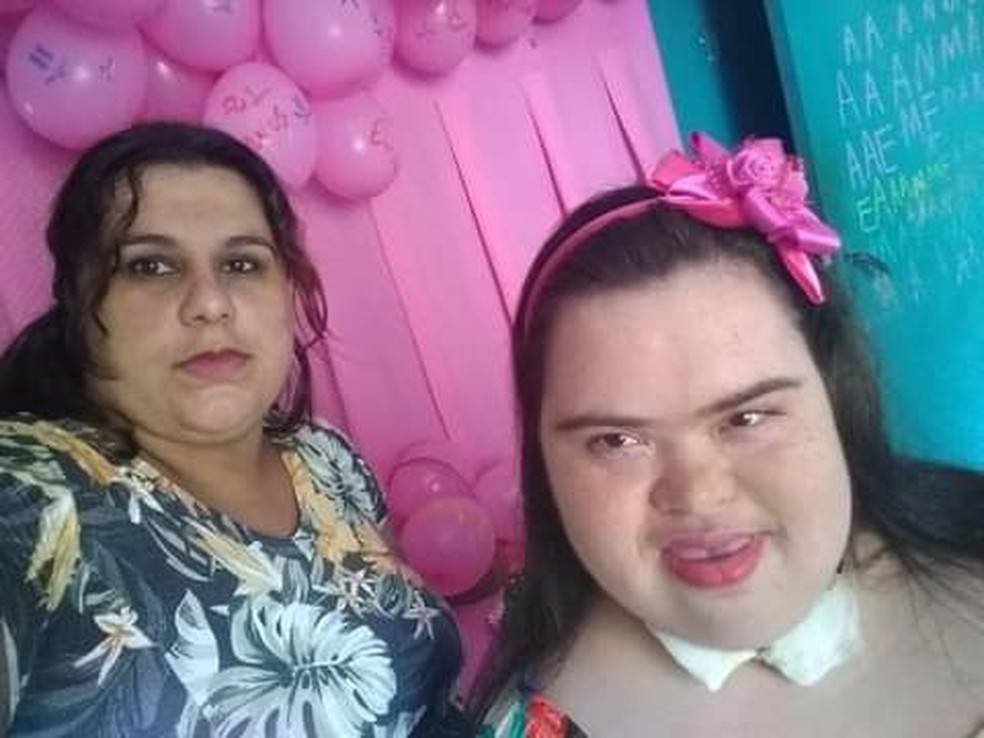 Jovem de 21 anos com Down que venceu Covid morre após reinfecção