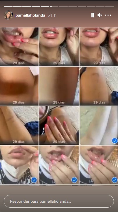 Agressões DJ Ivis Pamella Holanda A imagem mostra uma série de fotos do rolo da câmera de Pamela, todas com marcas de agressões em seu corpo e rosto