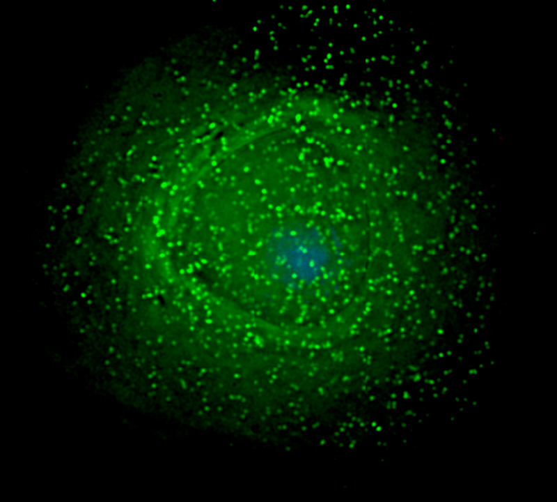 Envoltório verde junto a uma estrutura azul: HIV junto a uma célula de defesa