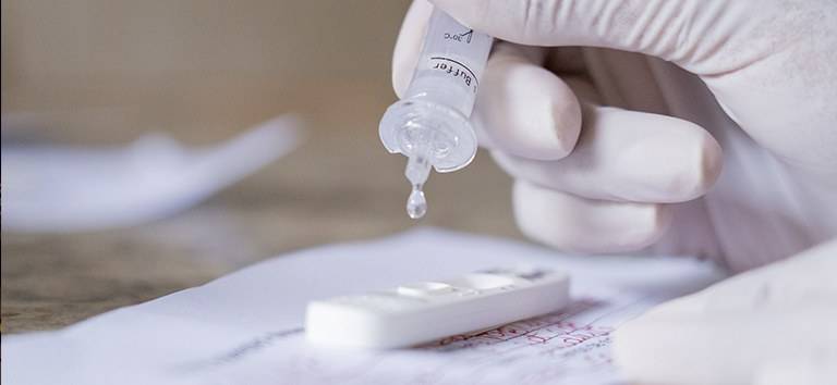 Anvisa libera venda de autotestes de Covid no Brasil