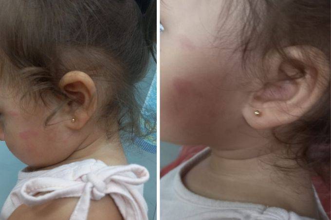 Vídeo mostra funcionária dando puxões de cabelo em bebê em escola infantil
