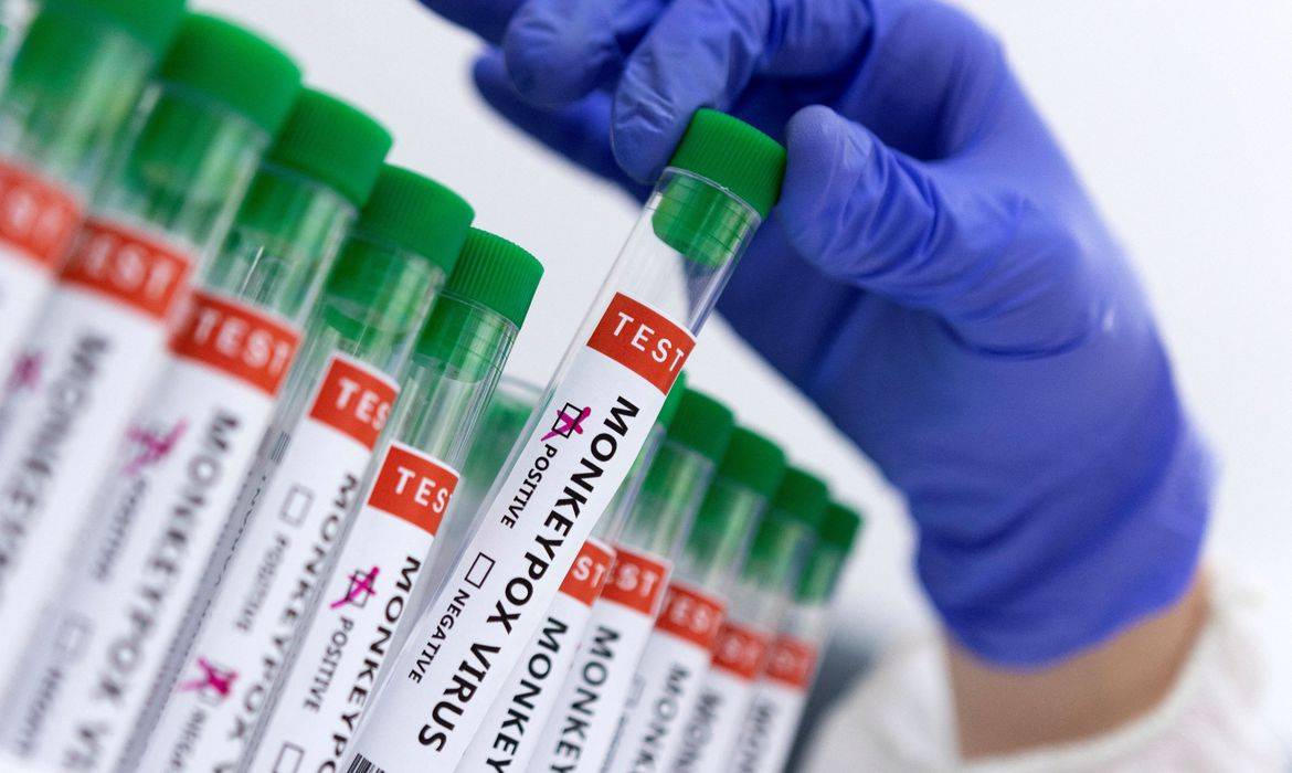 Estudo aborda transmissão de varíola dos macacos por superfície