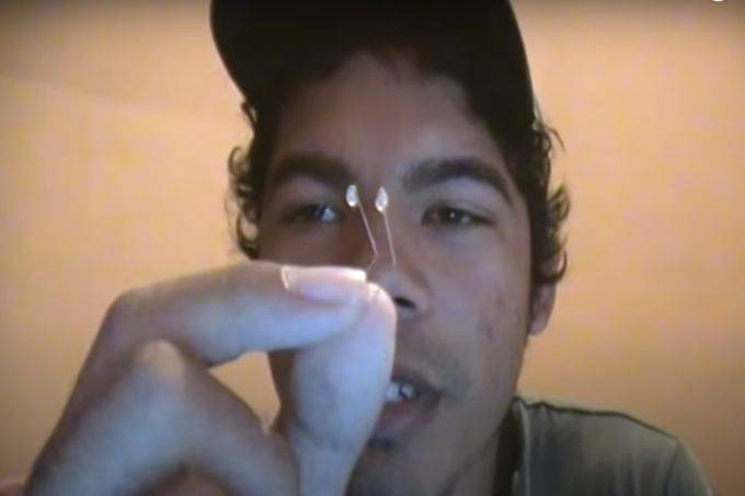 Homem se fere após fazer rinoplastia caseira seguindo dicas da internet