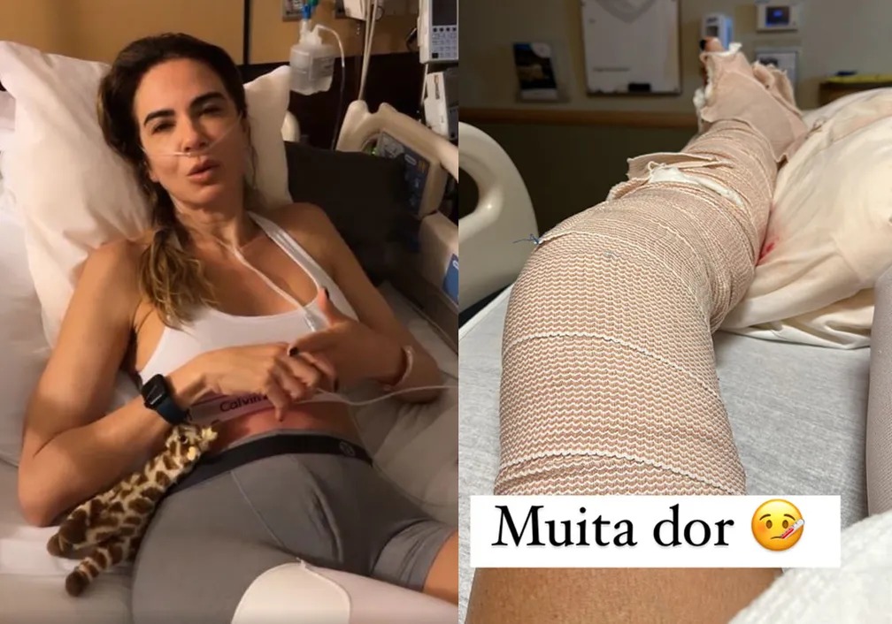 Montagem com duas capturas de tela de vídeo de Luciana Gimenez: a primeira mostra a apresentadora sentada em uma cama de hospital, falando, usando top branco; a segunda mostra sua perna enfaixada, com a legenda "Muita dor"
