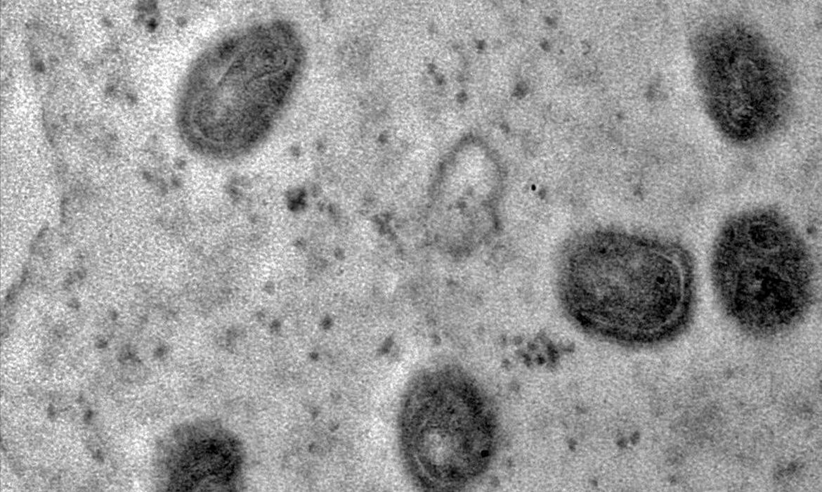 A varíola dos macacos é transmitida pelo vírus monkeypox, que pertence ao gênero orthopoxvirus