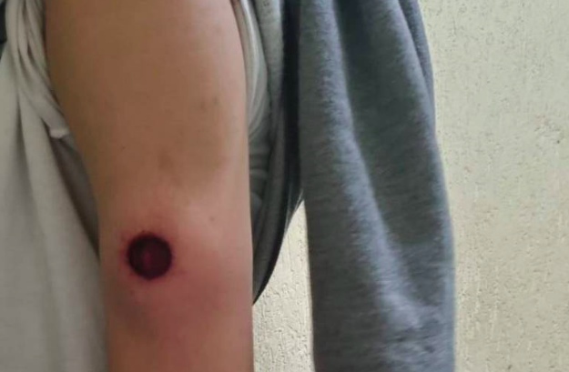 Dependente químico é atingido por bala de borracha na Cracolândia