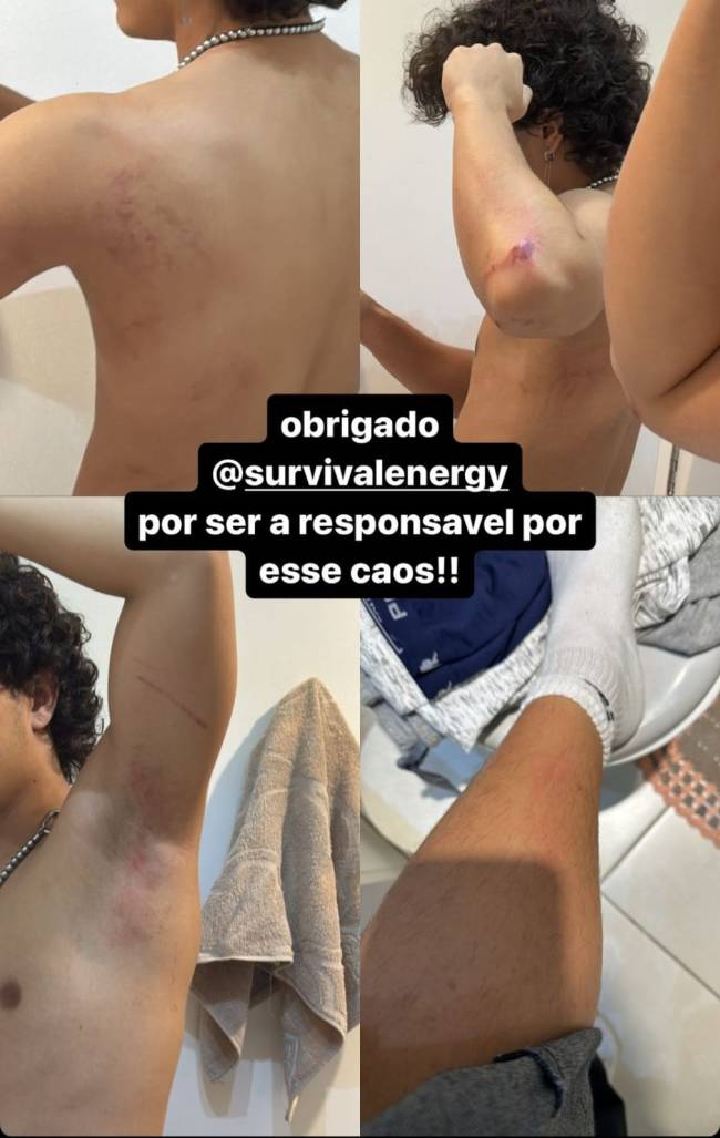 Ferimento nike tumulto-pisoteamento-paraiso-nike