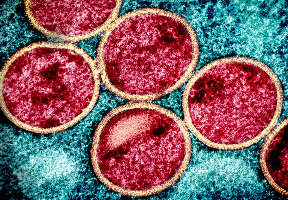 virus-mpox
