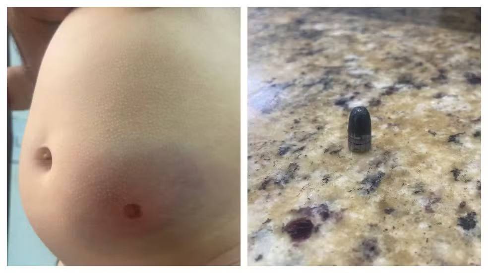 Bebê de 11 meses é atingida por bala perdida dentro de casa no Réveillon