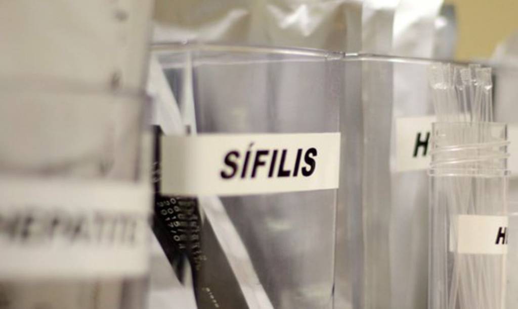 Praça Roosevelt tem testagem grátis de HIV, hepatite, síflis e gonorreia