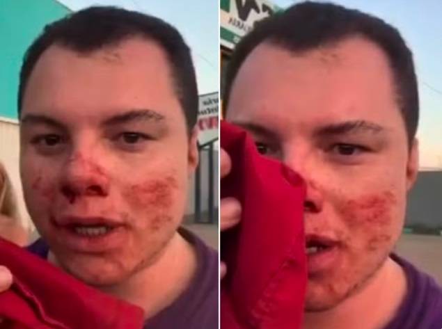 Influenciador agredido nos jogos universitários Economíadas acorda do coma