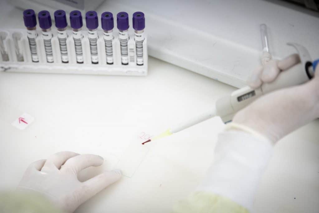 Saúde de São Paulo investiga caso suspeito de Ebola
