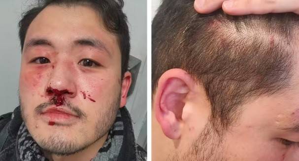 Professor denuncia agressão por homofobia no Metrô de SP